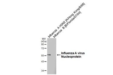 Anti-Influenza A virus Nucleoprotein antibody [GT23] used in Western Blot (WB). GTX641086