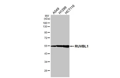 Anti-RUVBL1 antibody [HL3323] used in Western Blot (WB). GTX641088