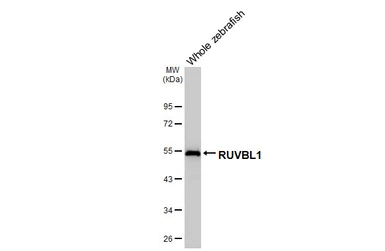 Anti-RUVBL1 antibody [HL3323] used in Western Blot (WB). GTX641088
