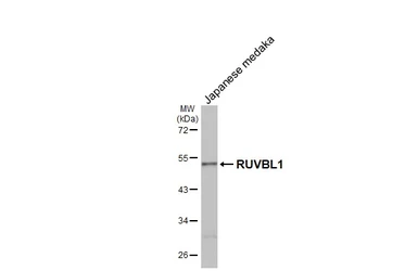 Anti-RUVBL1 antibody [HL3323] used in Western Blot (WB). GTX641088