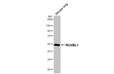 Anti-RUVBL1 antibody [HL3323] used in Western Blot (WB). GTX641088
