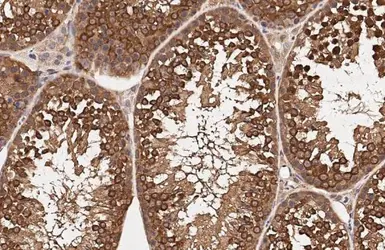 Anti-RUVBL1 antibody [HL3323] used in IHC (Paraffin sections) (IHC-P). GTX641088