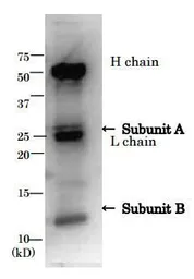 Anti-E. coli LT toxin antibody used in Immunoprecipitation (IP). GTX64109