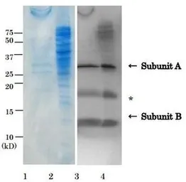 Anti-E. coli LT toxin antibody used in Western Blot (WB). GTX64109