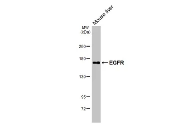 Anti-EGFR antibody [HL3325] used in Western Blot (WB). GTX641090