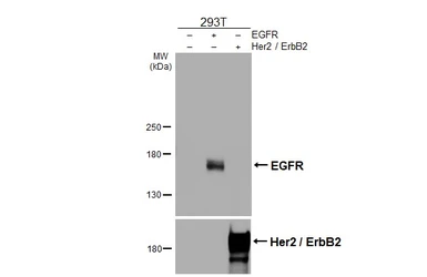 Anti-EGFR antibody [HL3325] used in Western Blot (WB). GTX641090
