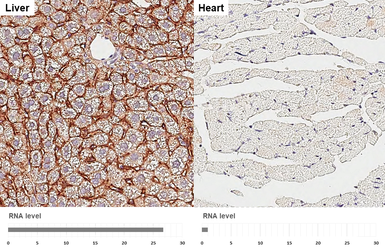 Anti-EGFR antibody [HL3325] used in IHC (Paraffin sections) (IHC-P). GTX641090