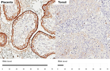 Anti-EGFR antibody [HL3325] used in IHC (Paraffin sections) (IHC-P). GTX641090