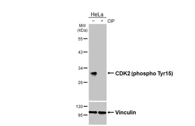 Anti-CDK2 (phospho Tyr15) antibody [HL3327] used in Western Blot (WB). GTX641092