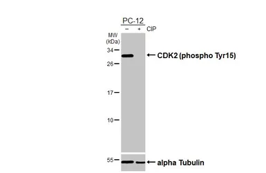 Anti-CDK2 (phospho Tyr15) antibody [HL3327] used in Western Blot (WB). GTX641092