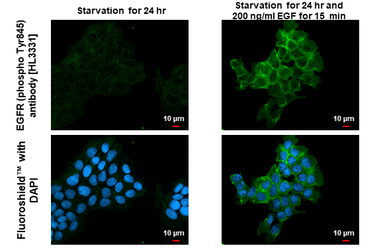 Anti-EGFR (phospho Tyr845) antibody [HL3331] used in Immunocytochemistry/ Immunofluorescence (ICC/IF). GTX641096