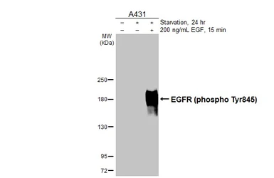 Anti-EGFR (phospho Tyr845) antibody [HL3331] used in Western Blot (WB). GTX641096