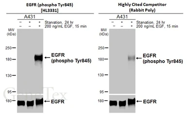 Anti-EGFR (phospho Tyr845) antibody [HL3331] used in Western Blot (WB). GTX641096