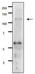 Anti-Gal 11 (S. cerevisiae) antibody used in Western Blot (WB). GTX64110