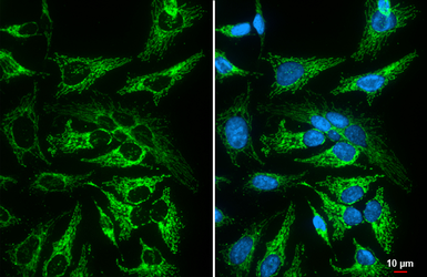 Anti-MFF antibody [GT26] used in Immunocytochemistry/ Immunofluorescence (ICC/IF). GTX641105