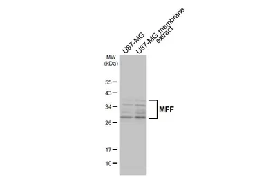 Anti-MFF antibody [GT26] used in Western Blot (WB). GTX641105