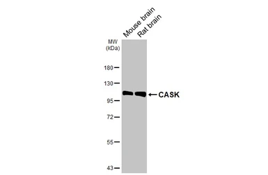 Anti-CASK antibody [GT27] used in Western Blot (WB). GTX641106