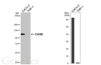 Anti-CASK antibody [GT27] used in Western Blot (WB). GTX641106