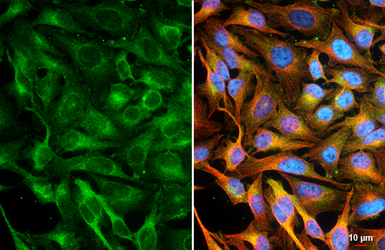 Anti-CASK antibody [GT27] used in Immunocytochemistry/ Immunofluorescence (ICC/IF). GTX641106