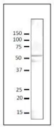 Anti-Gcn5p (S. cerevisiae) antibody used in Western Blot (WB). GTX64111