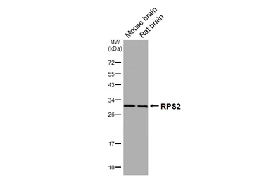 Anti-RPS2 antibody [HL3338] used in Western Blot (WB). GTX641110