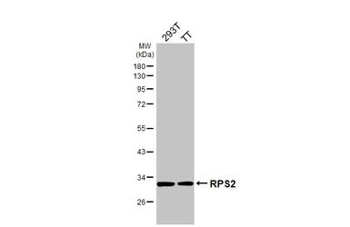 Anti-RPS2 antibody [HL3338] used in Western Blot (WB). GTX641110