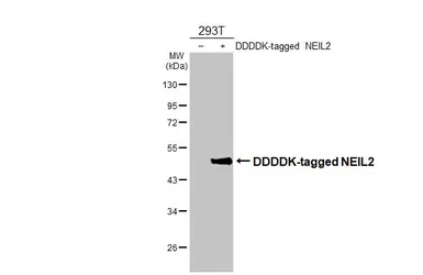 Anti-NEIL2 antibody [HL3343] used in Western Blot (WB). GTX641115