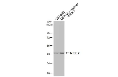 Anti-NEIL2 antibody [HL3343] used in Western Blot (WB). GTX641115
