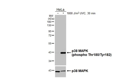 Anti-p38 MAPK (phospho Thr180/Tyr182) antibody [HL3344] used in Western Blot (WB). GTX641116