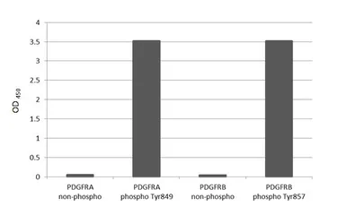 Anti-PDGF Receptor alpha (phospho Tyr849) + PDGF Receptor beta (phospho Tyr857) antibody [HL3345] used in  (). GTX641117