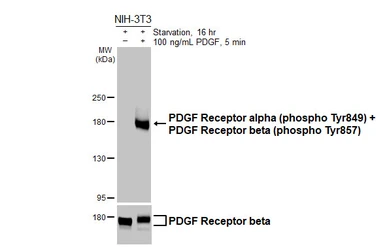 Anti-PDGF Receptor alpha (phospho Tyr849) + PDGF Receptor beta (phospho Tyr857) antibody [HL3345] used in Western Blot (WB). GTX641117