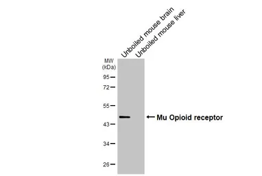 Anti-Mu Opioid receptor antibody [HL3348] used in Western Blot (WB). GTX641120