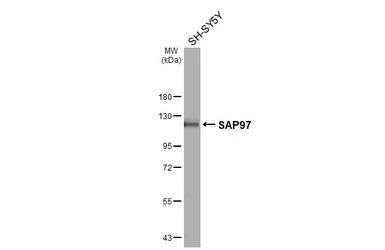 Anti-SAP97 antibody [GT31] used in Western Blot (WB). GTX641123