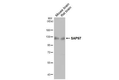 Anti-SAP97 antibody [GT31] used in Western Blot (WB). GTX641123
