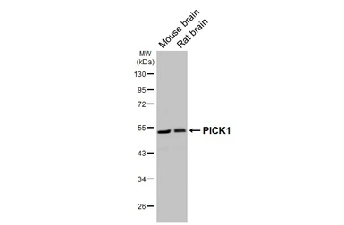 Anti-PICK1 antibody [GT32] used in Western Blot (WB). GTX641124