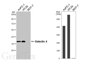 Anti-Galectin 4 antibody [HL3349] used in Western Blot (WB). GTX641126