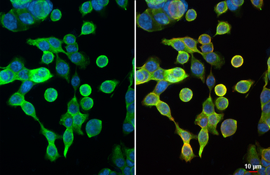 Anti-Galectin 4 antibody [HL3350] used in Immunocytochemistry/ Immunofluorescence (ICC/IF). GTX641127