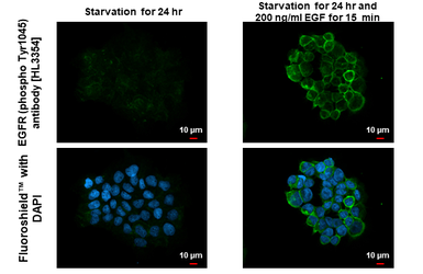 Anti-EGFR (phospho Tyr1045) antibody [HL3354] used in Immunocytochemistry/ Immunofluorescence (ICC/IF). GTX641131