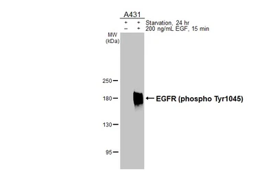 Anti-EGFR (phospho Tyr1045) antibody [HL3354] used in Western Blot (WB). GTX641131