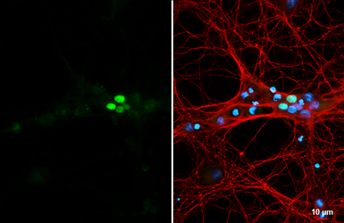 Anti-NeuroD1 antibody [HL3356] used in Immunocytochemistry/ Immunofluorescence (ICC/IF). GTX641133