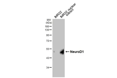 Anti-NeuroD1 antibody [HL3356] used in Western Blot (WB). GTX641133