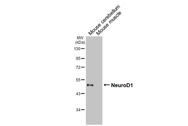 Anti-NeuroD1 antibody [HL3356] used in Western Blot (WB). GTX641133