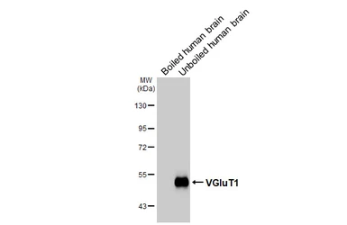 Anti-VGluT1 antibody [GT34] used in Western Blot (WB). GTX641142