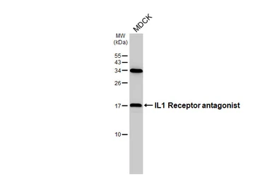 Anti-IL1 Receptor antagonist antibody [HL3366] used in Western Blot (WB). GTX641186