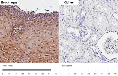 Anti-IL1 Receptor antagonist antibody [HL3366] used in IHC (Paraffin sections) (IHC-P). GTX641186
