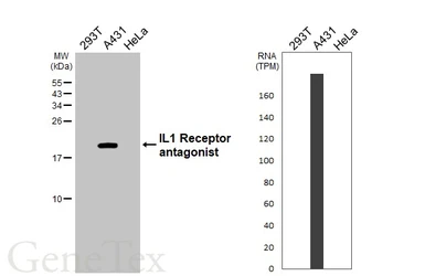Anti-IL1 Receptor antagonist antibody [HL3366] used in Western Blot (WB). GTX641186
