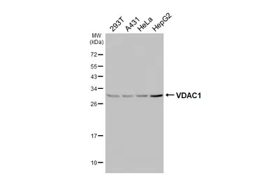 Anti-VDAC1 antibody [HL3373] used in Western Blot (WB). GTX641193