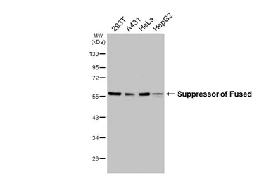 Anti-Suppressor of Fused antibody [HL3374] used in Western Blot (WB). GTX641194
