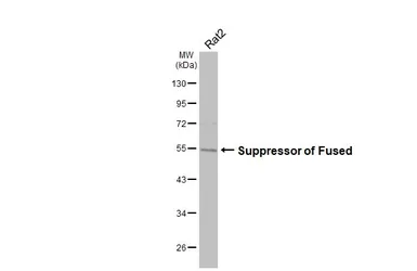 Anti-Suppressor of Fused antibody [HL3374] used in Western Blot (WB). GTX641194