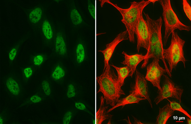 Anti-Suppressor of Fused antibody [HL3375] used in Immunocytochemistry/ Immunofluorescence (ICC/IF). GTX641195